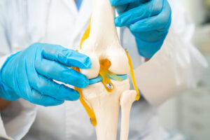 Anatomisches Modell des Kniegelenks mit Bändern und Knorpelstruktur