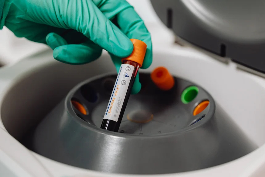 Blutprobe in einem Laborgerät zur medizinischen Diagnostik